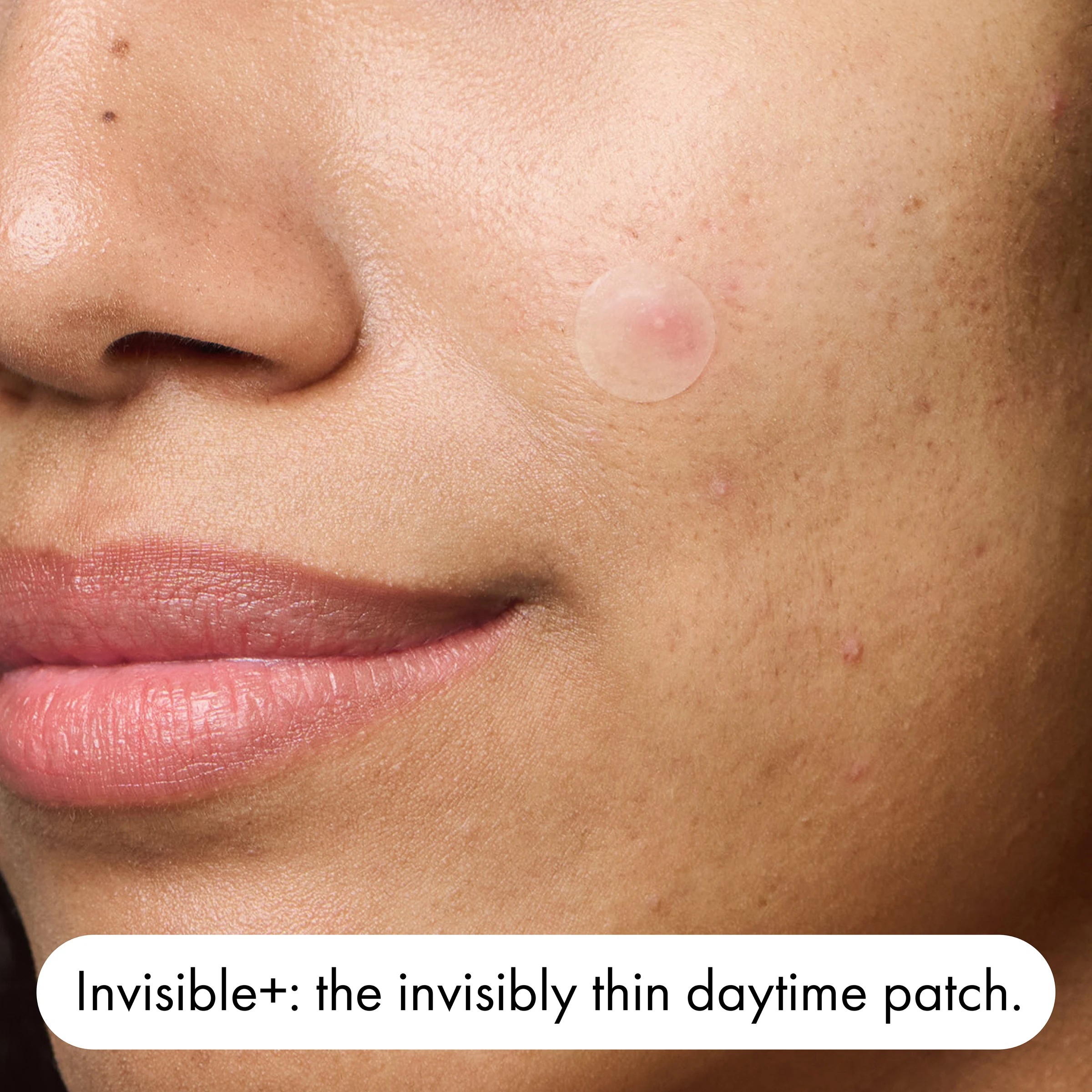 5 Hero 12 Pack Mighty Patch Duo Pimple Patches - Hydrocolloid, 5 of 10