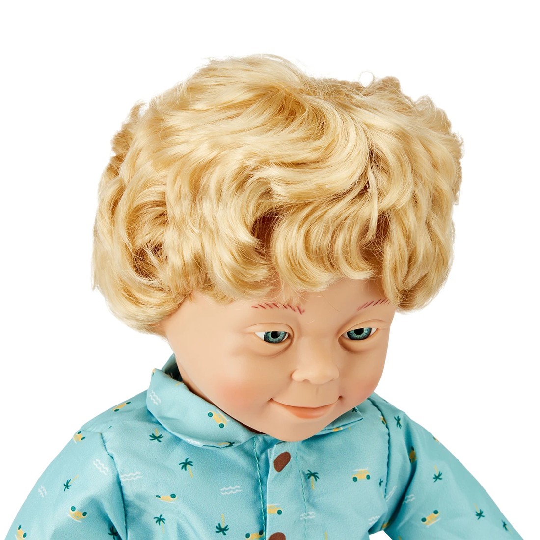 5 Baby Oliver with Down Syndrome, 5 of 10