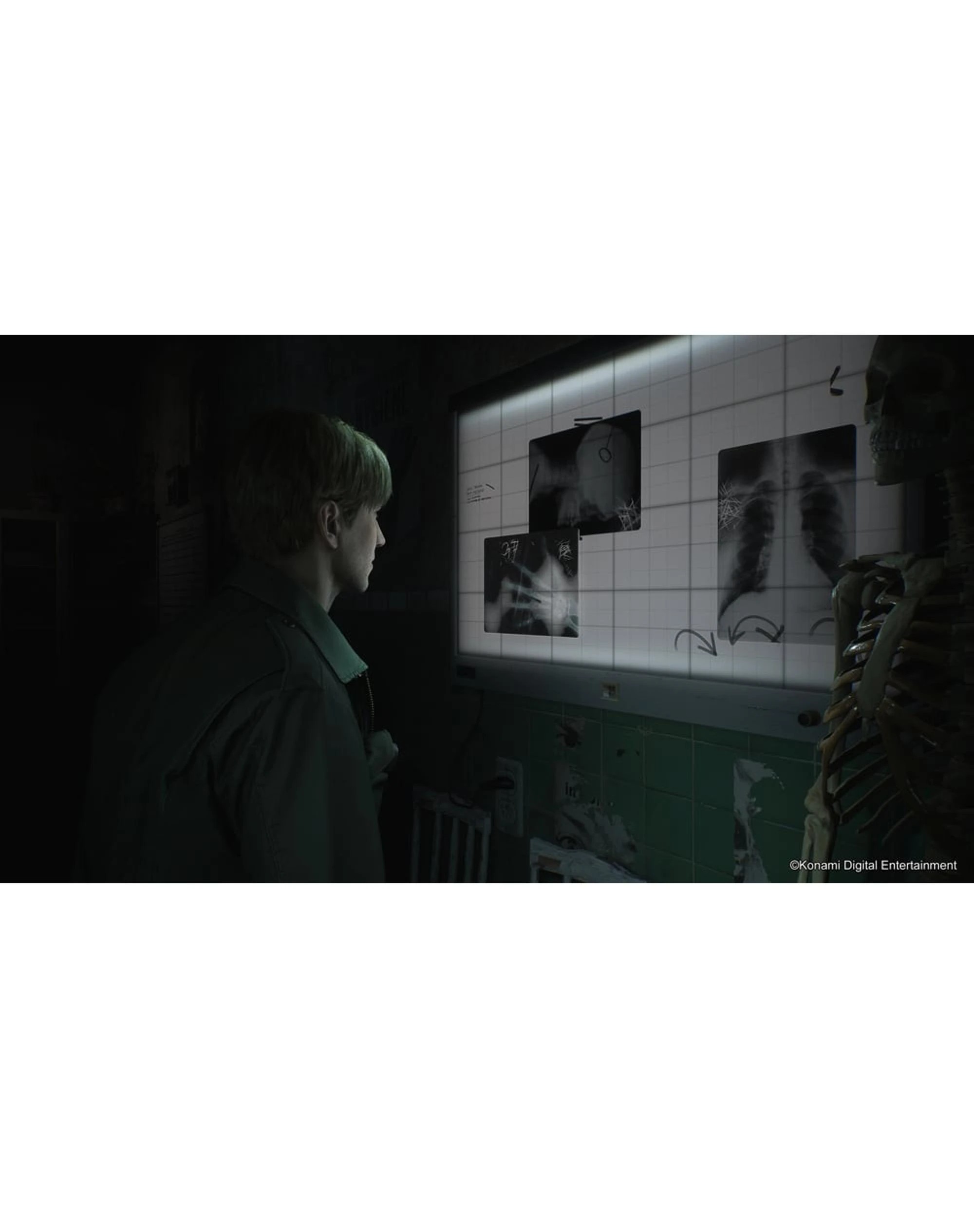 3 Silent Hill 2 Remake - PS5, 3 of 10