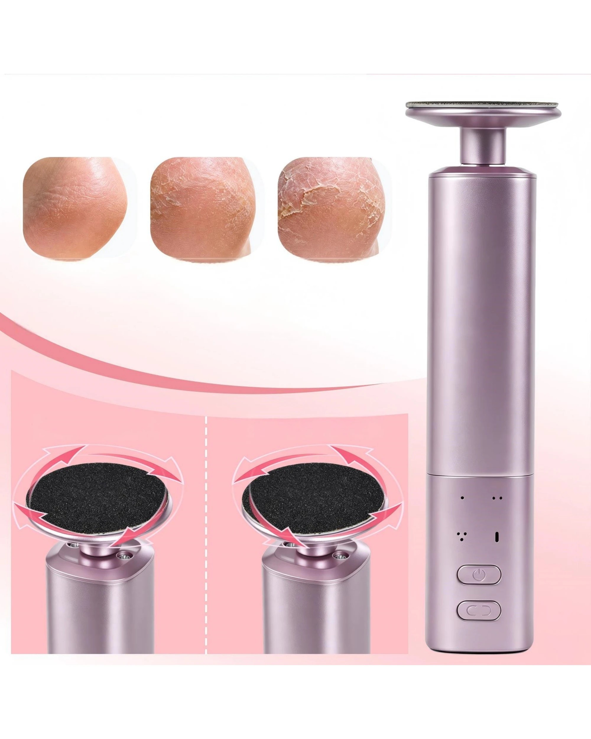 3 Advwin 2-IN-1 Foot Callus Remover with 70 Pcs Sandpaper - Pink, 3 of 7