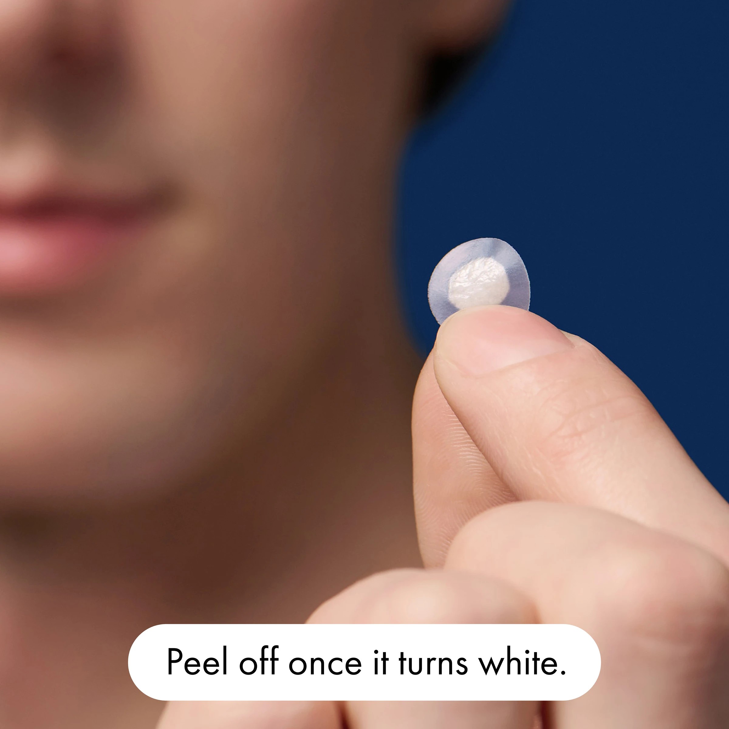 5 Hero 24 Pack Mighty Patch The Original Pimple Patches - Hydrocolloid, 5 of 10