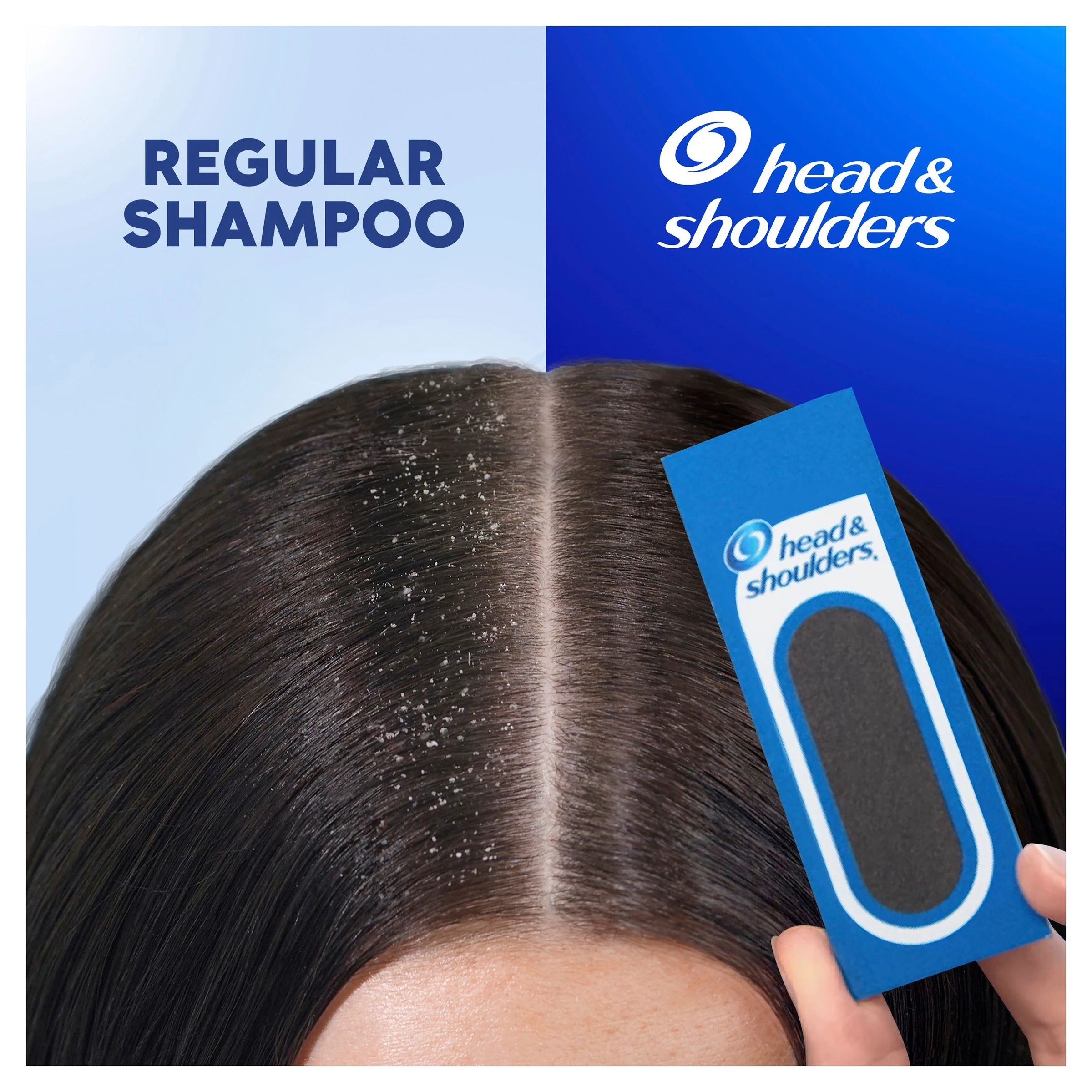 8 Head & Shoulders Anti-Dandruff Shampoo 80ml, 8 of 8