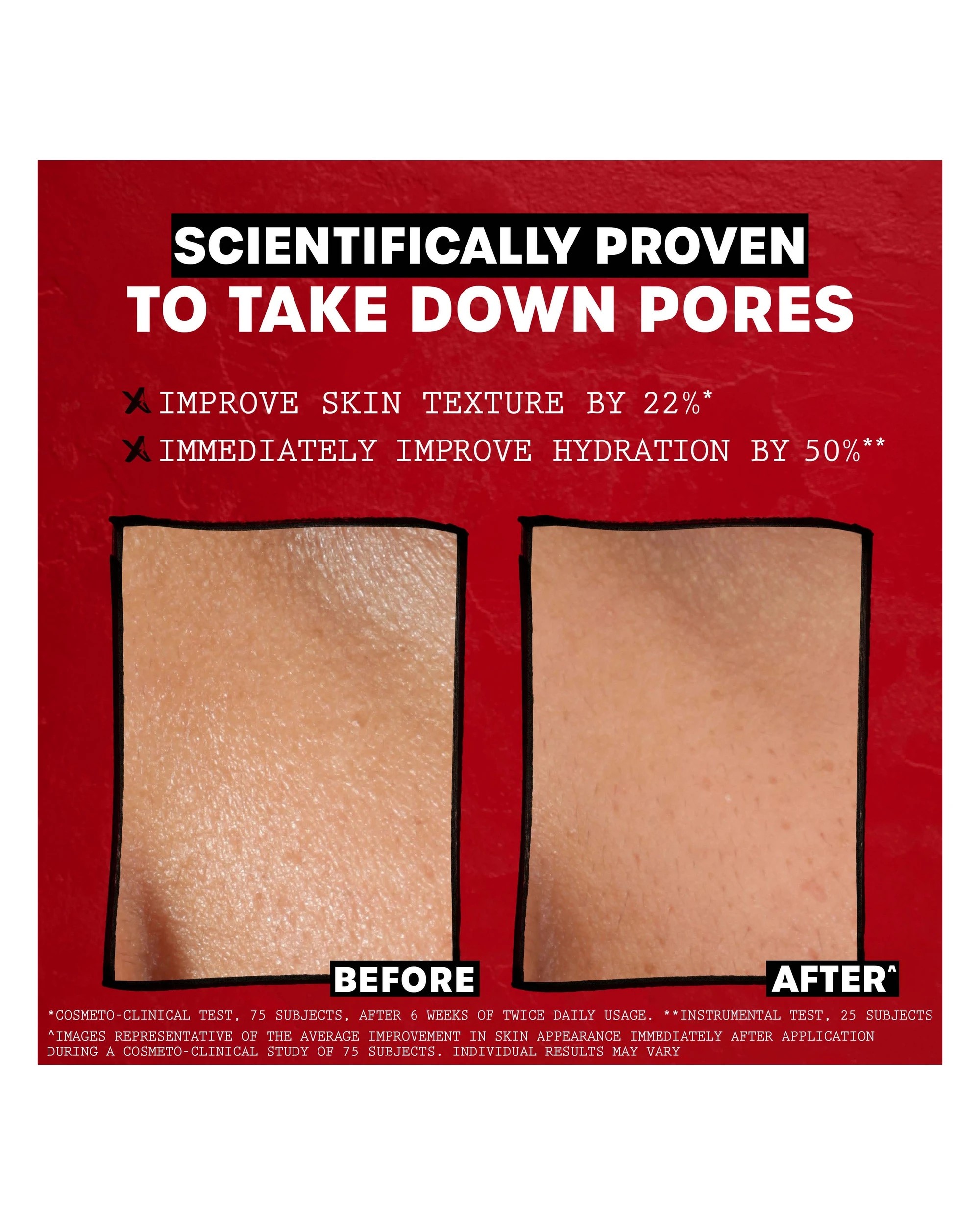 5 Thayers Unscented Alcohol Free Facial Toner 355ml - Witch Hazel and Aloe Vera, 5 of 9