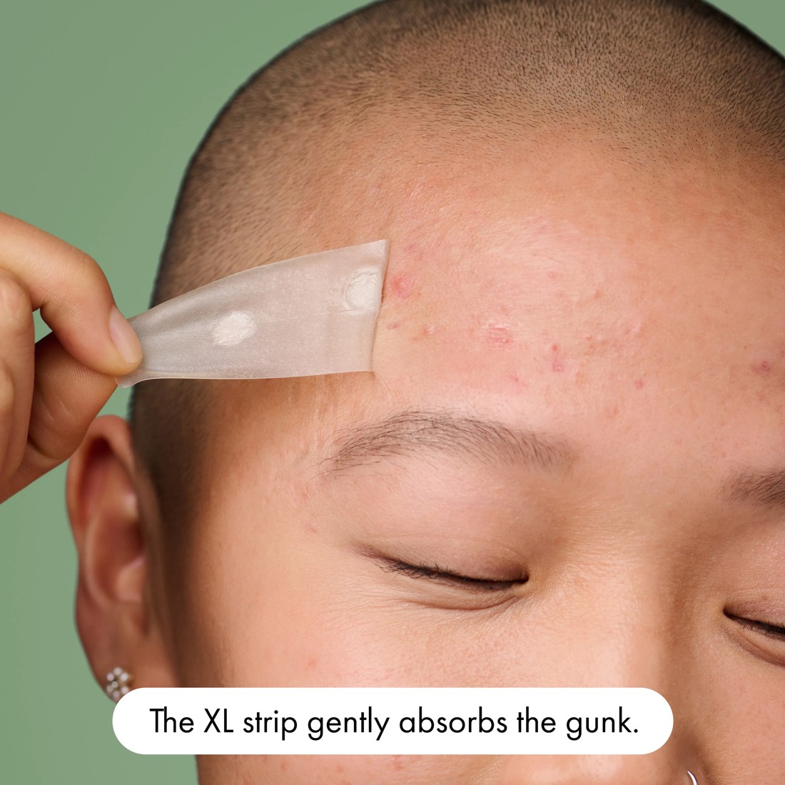 6 Hero 10 Pack Mighty Patch Surface Pimple Patches - Hydrocolloid, 6 of 10