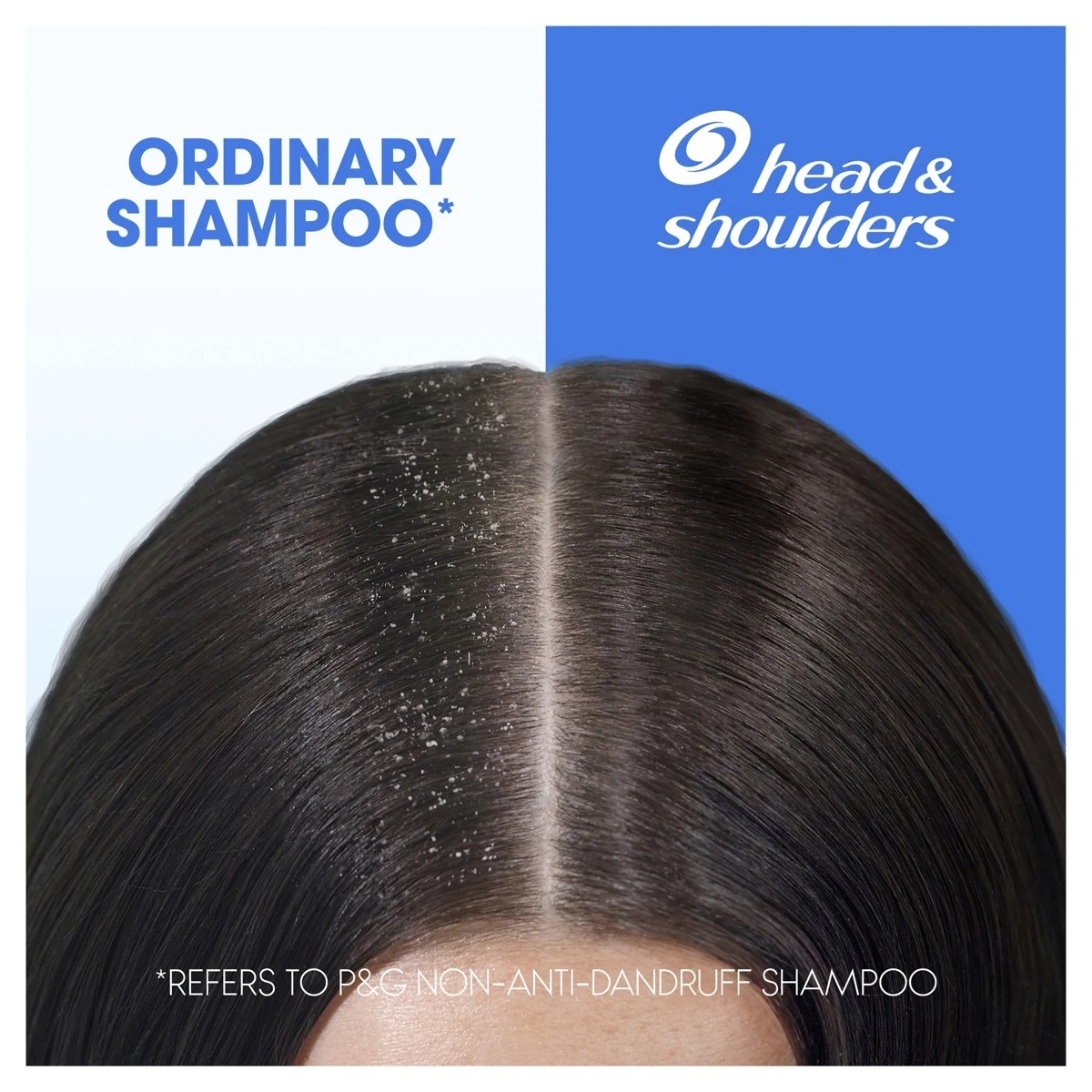 8 Head & Shoulders 2-in-1 Clean & Balanced Anti Dandruff Shampoo and Conditioner 350ml, 8 of 10
