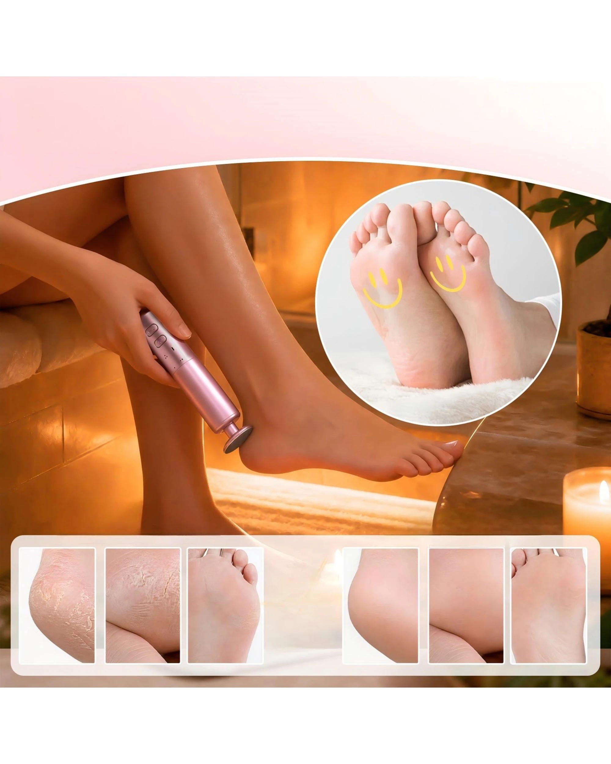 7 Advwin 2-IN-1 Foot Callus Remover with 70 Pcs Sandpaper - Pink, 7 of 7