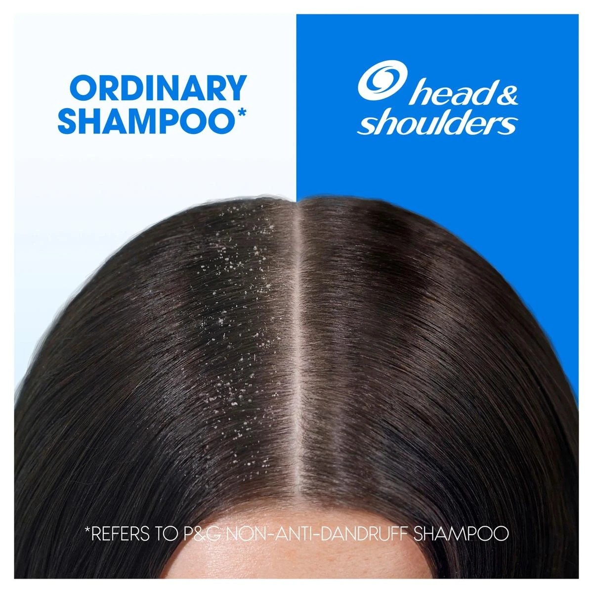 8 Head & Shoulders 2-in-1 Itchy Scalp Care Shampoo and Conditioner, 8 of 10