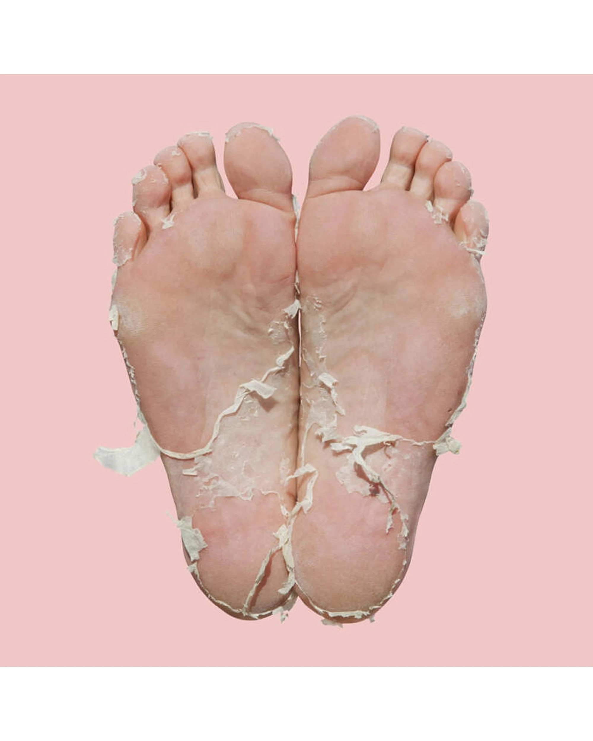 4 Skin Republic Foot Peel, 4 of 6