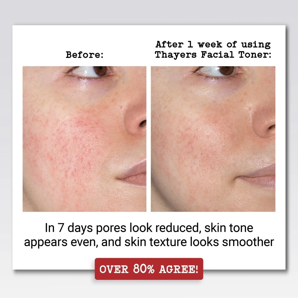 5 Thayers Unscented Alcohol Free Facial Toner 355ml - Witch Hazel and Aloe Vera, 5 of 6