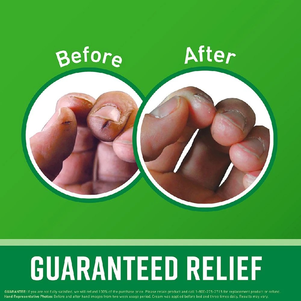 7 O'Keeffe's Working Hands Hand Cream 76g, 7 of 9