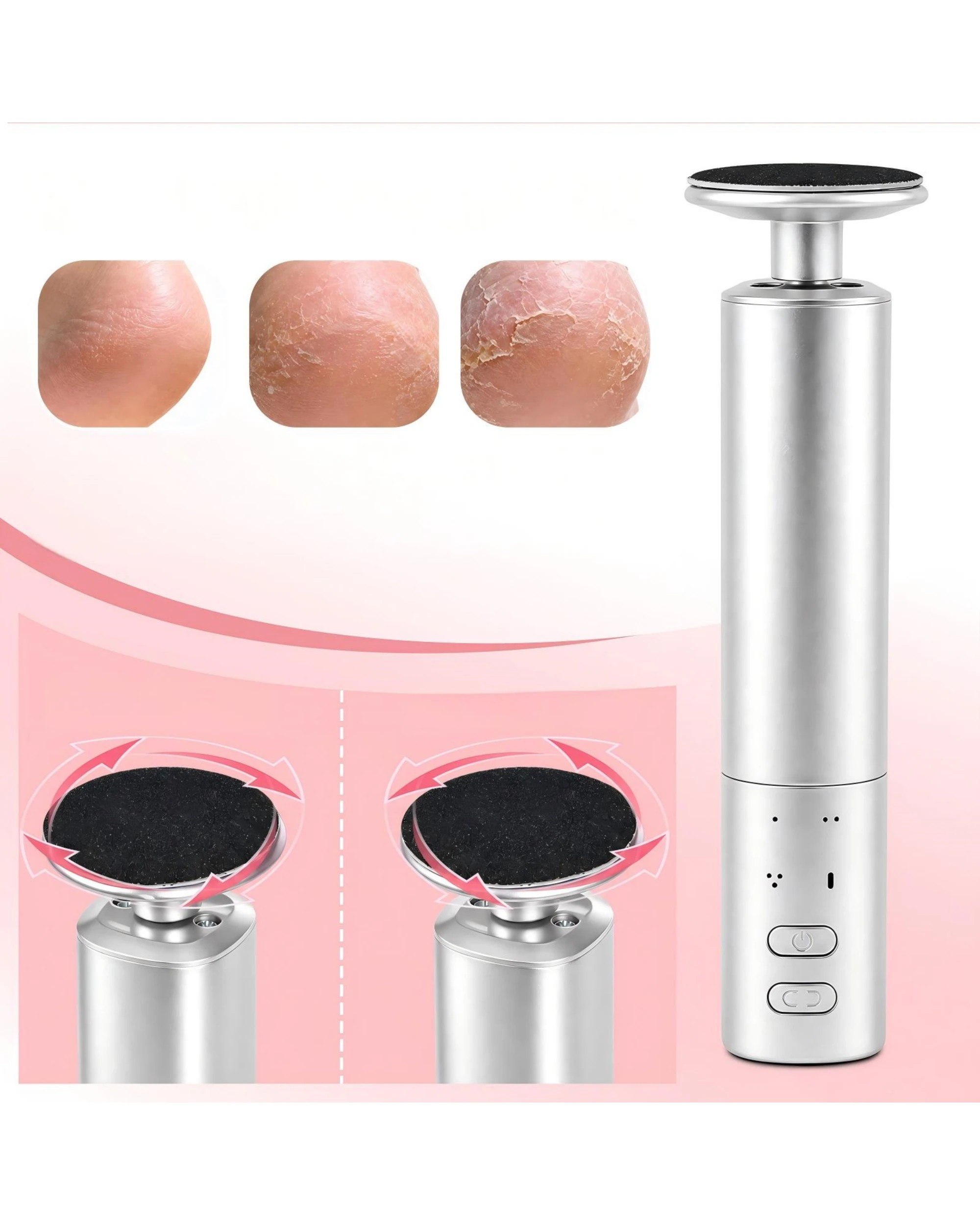 3 Advwin 2-IN-1 Foot Callus Remover with 70 Pcs Sandpaper - Silver, 3 of 7