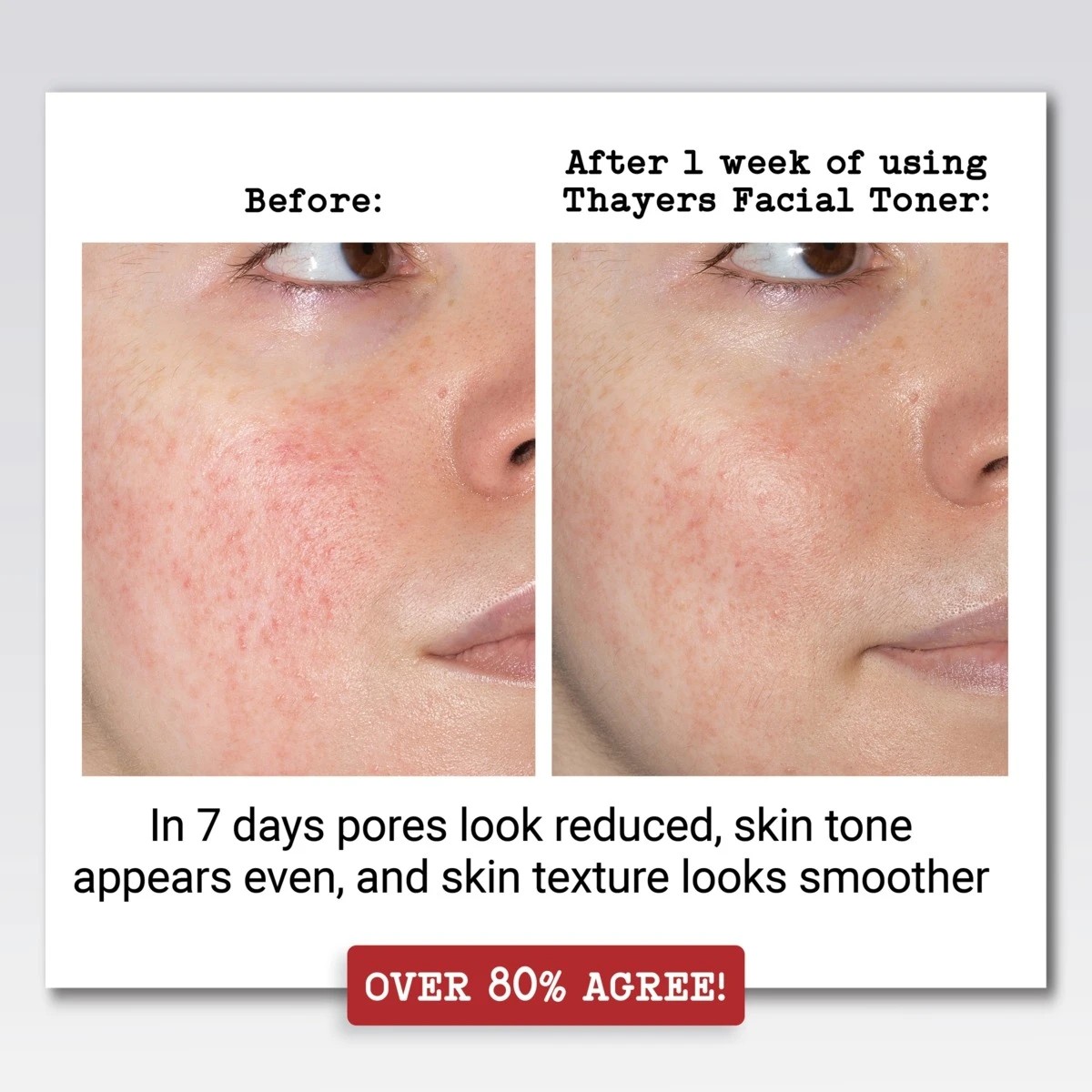 5 Thayers Rose Petal Alcohol Free Facial Toner 355ml - Witch Hazel and Aloe Vera, 5 of 6