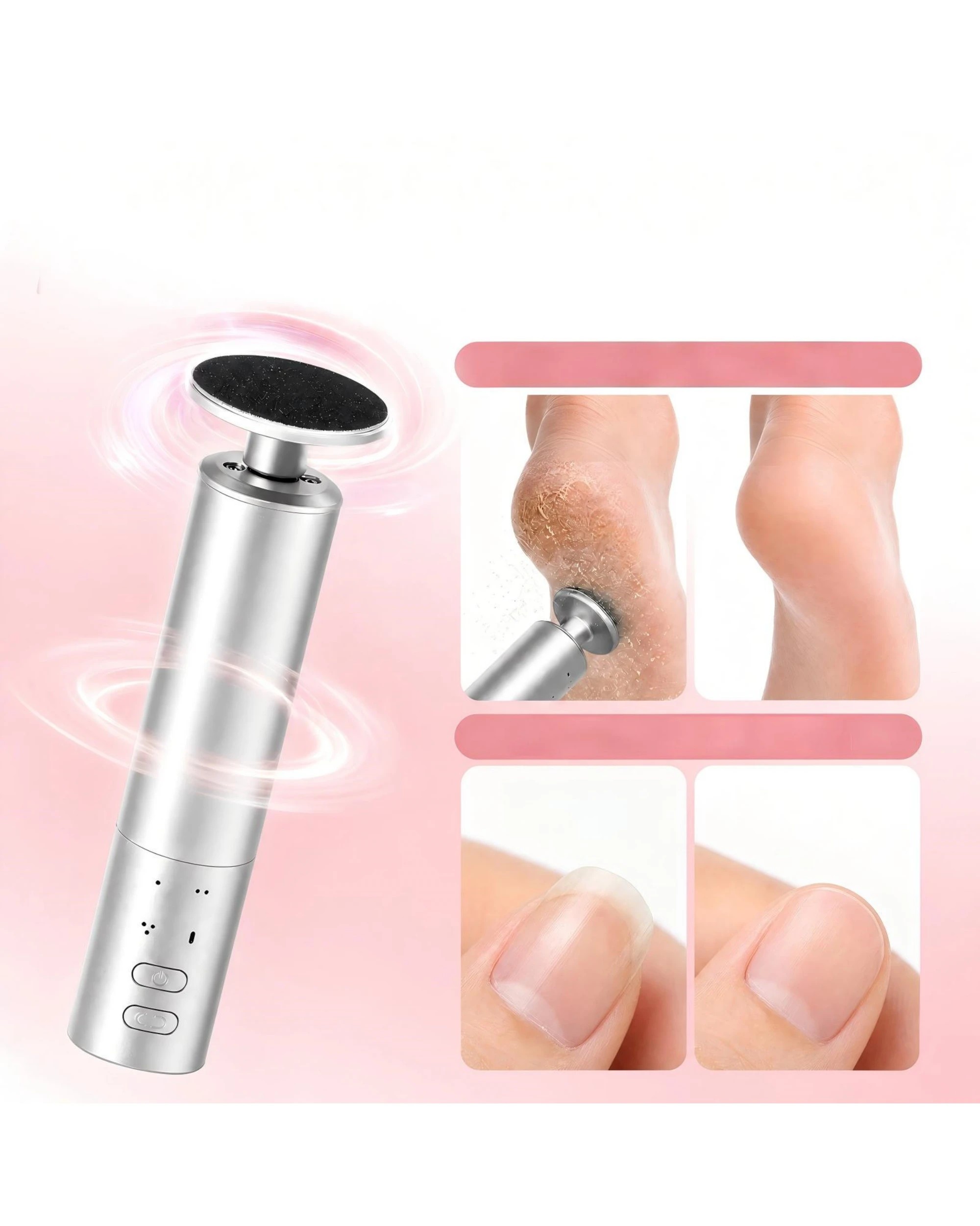 2 Advwin 2-IN-1 Foot Callus Remover with 70 Pcs Sandpaper - Silver, 2 of 7