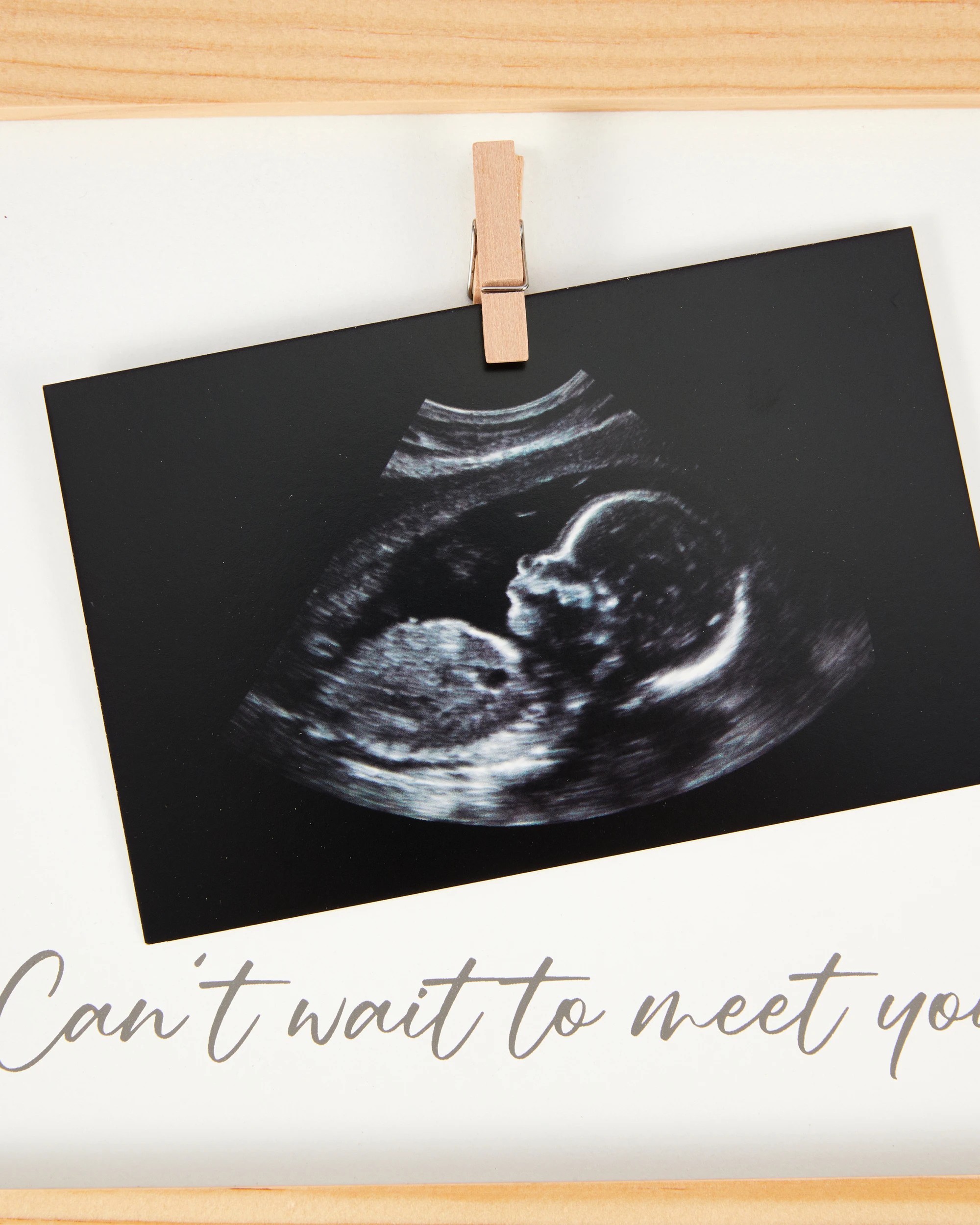 3 Ultrasound Wall Frame, 3 of 6