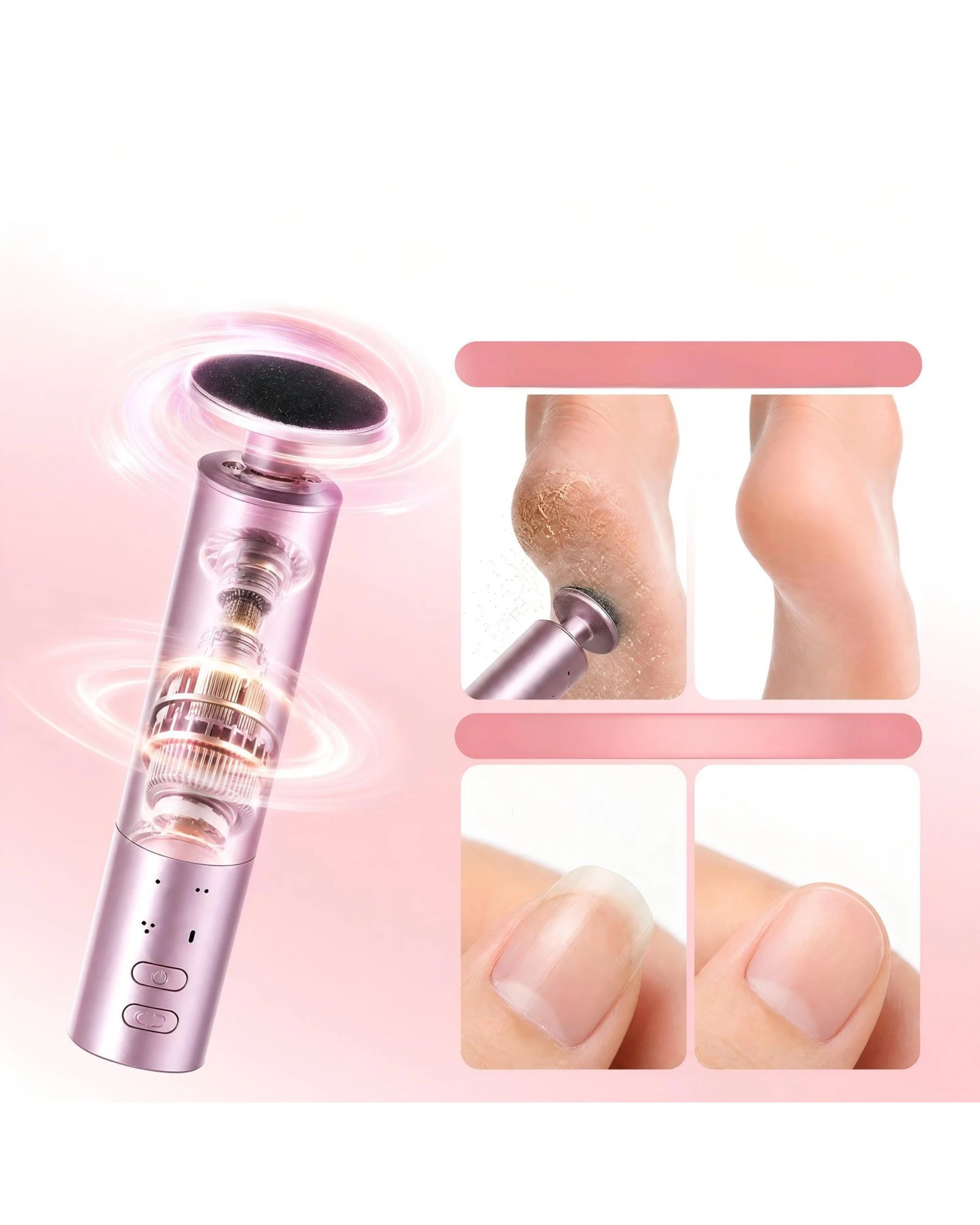 2 Advwin 2-IN-1 Foot Callus Remover with 70 Pcs Sandpaper - Pink, 2 of 7